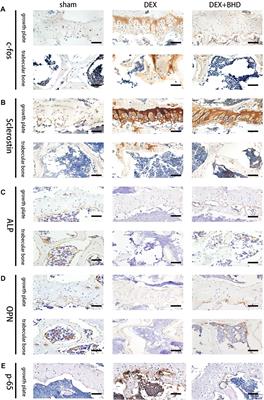 Corrigendum: Bushen huoxue decoction inhibits RANKL-stimulated osteoclastogenesis and glucocorticoid-induced bone loss by modulating the NF-κB, ERK, and JNK signaling pathways
